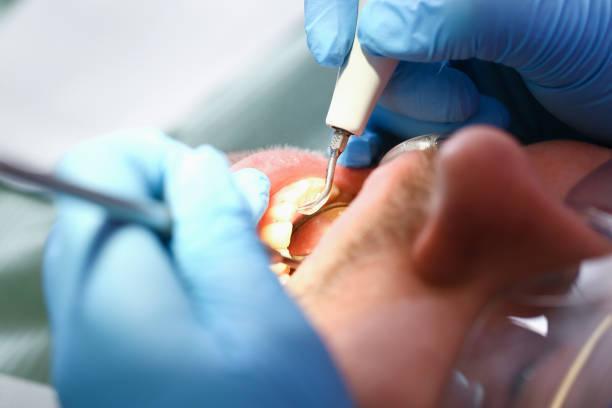 Best Emergency Treatment for Jaw Pain or Injury in Turtle Creek, PA
